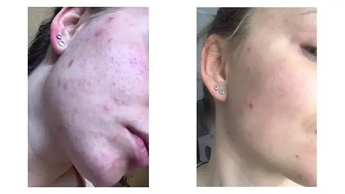 Zkušenosti jedné z vás